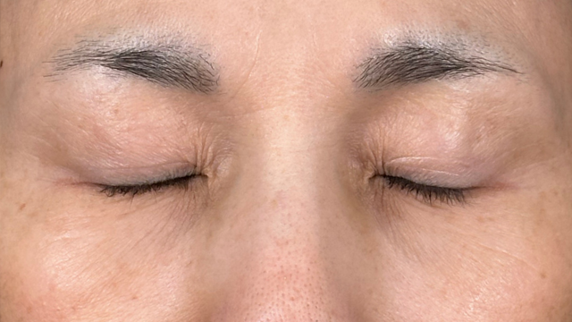 Postoperative Condition Part 1