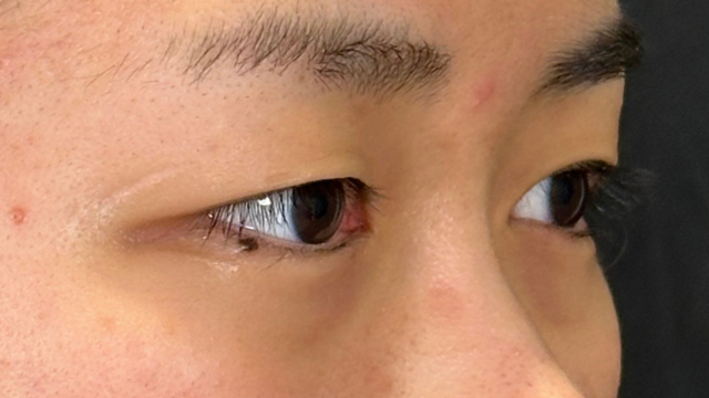 Postoperative Condition Part 1