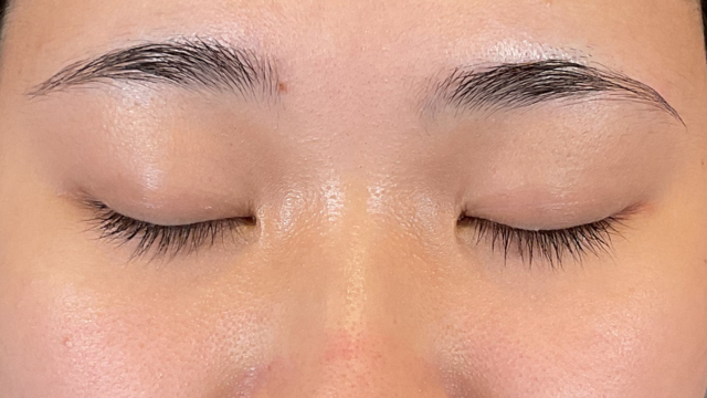 Postoperative Condition Part 1