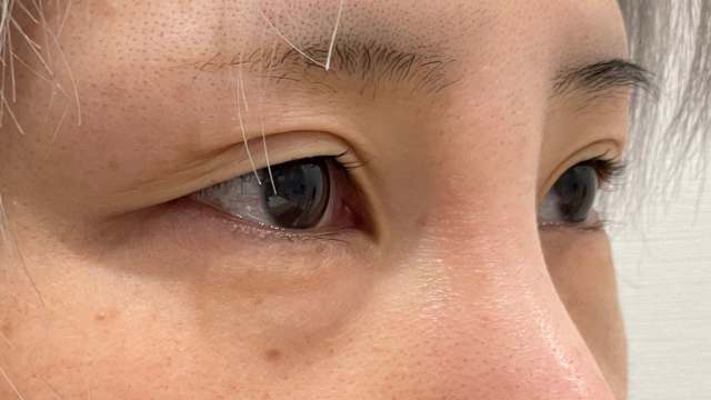 Postoperative Condition Part 1