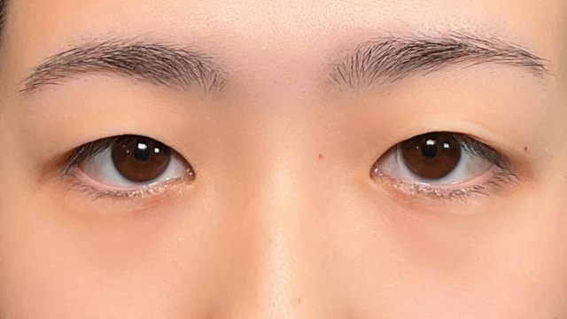 Postoperative Condition Part 1