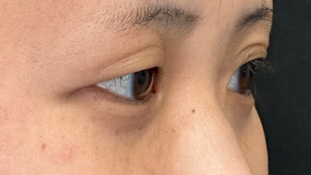 Postoperative Condition Part 1