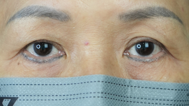 Postoperative Condition Part 1