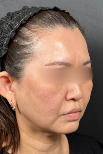 Postoperative Condition Part 1