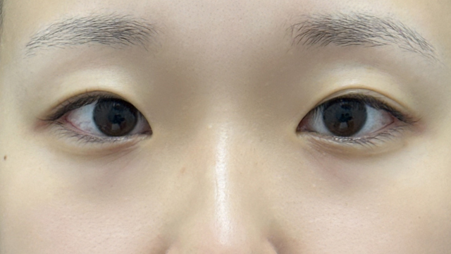 Postoperative Condition Part 1