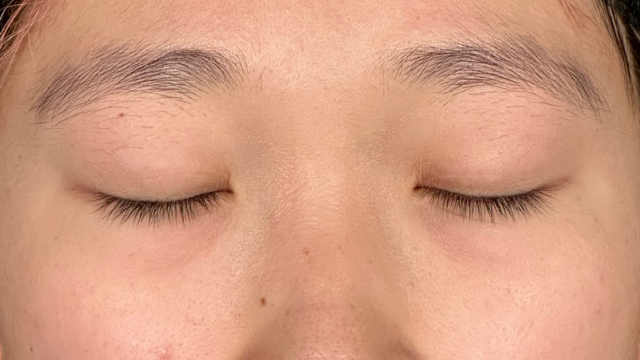 Postoperative Condition Part 1