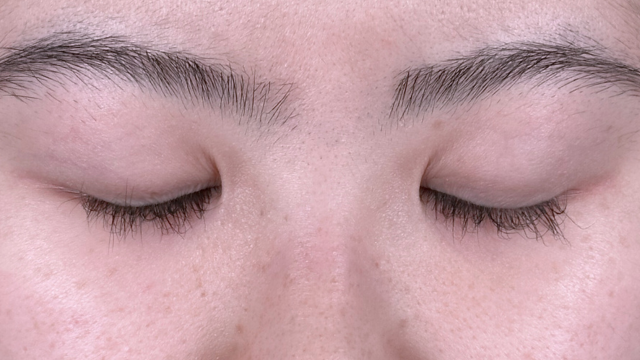 Postoperative Condition Part 1