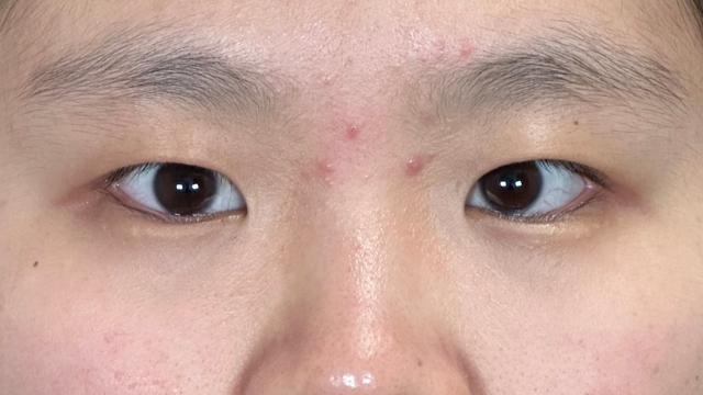 Postoperative Condition Part 1