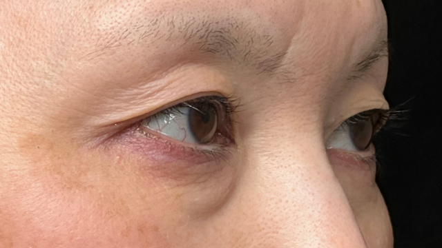 Postoperative Condition Part 1