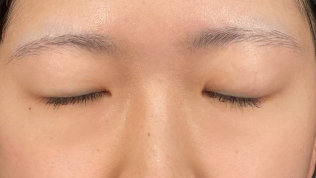 Postoperative Condition Part 1