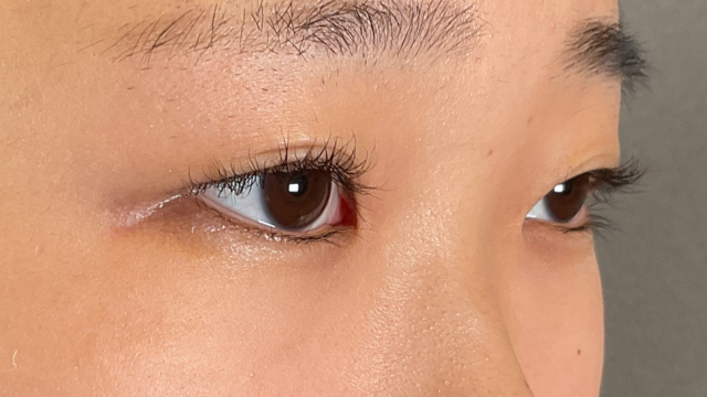 Postoperative Condition Part 1