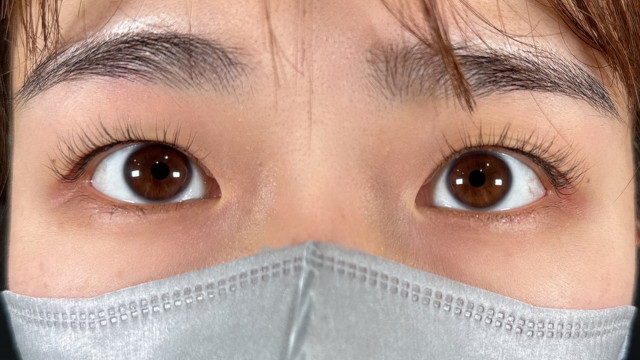 Postoperative Condition Part 1