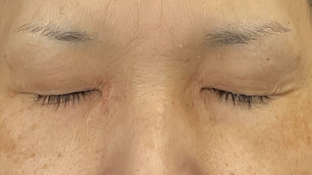 Postoperative Condition Part 1