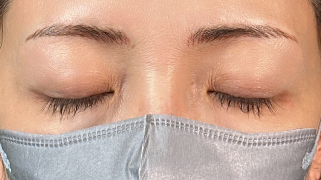 Postoperative Condition Part 1