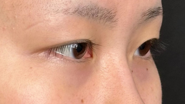 Postoperative Condition Part 1