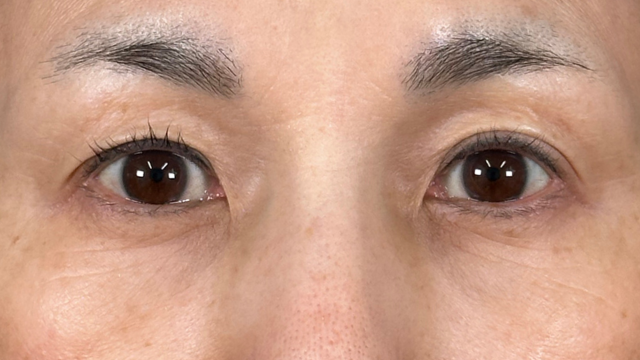 Postoperative Condition Part 1