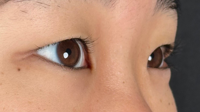 Postoperative Condition Part 1