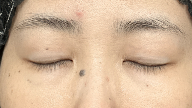 Postoperative Condition Part 1