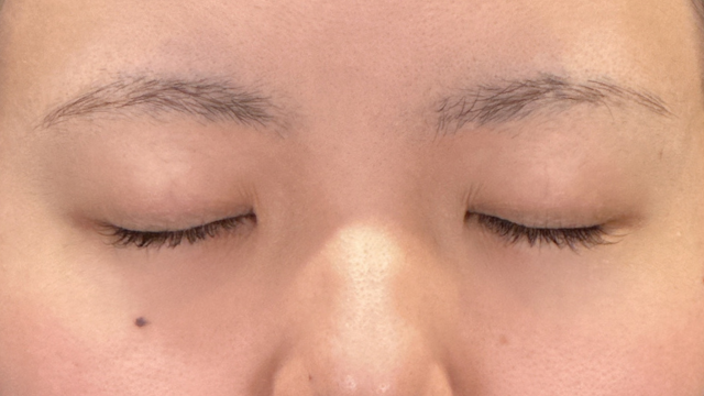 Postoperative Condition Part 1