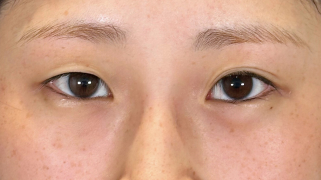 Postoperative Condition Part 1