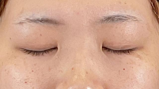 Postoperative Condition Part 1