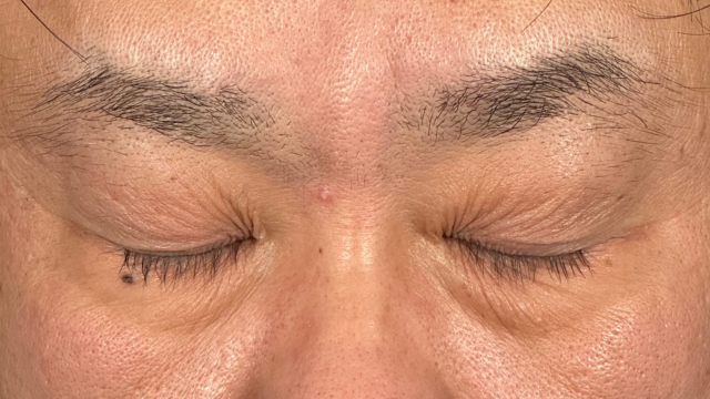 Postoperative Condition Part 1