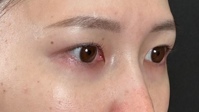 Postoperative Condition Part 1