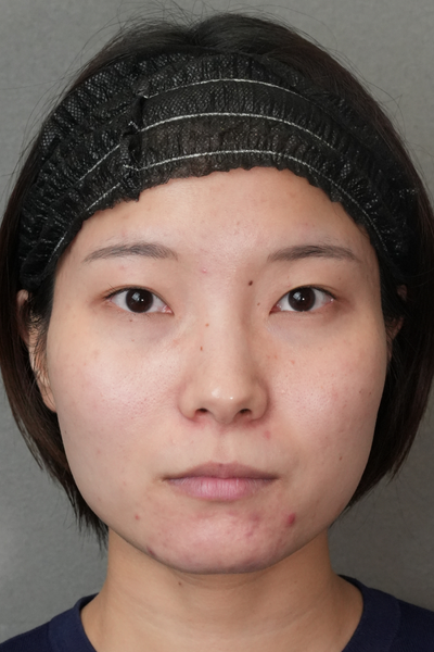 Postoperative Condition Part 1