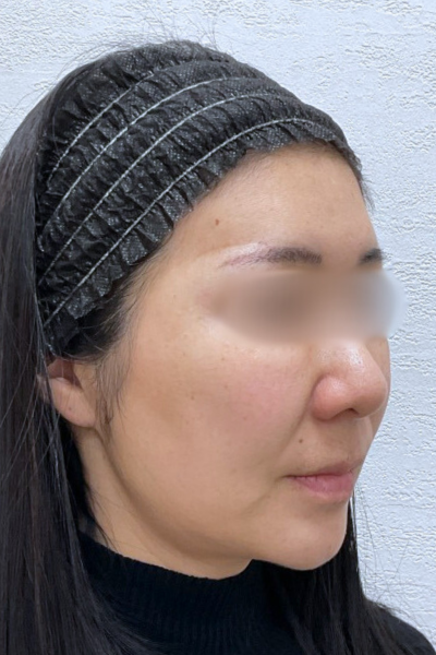 Postoperative Condition Part 1