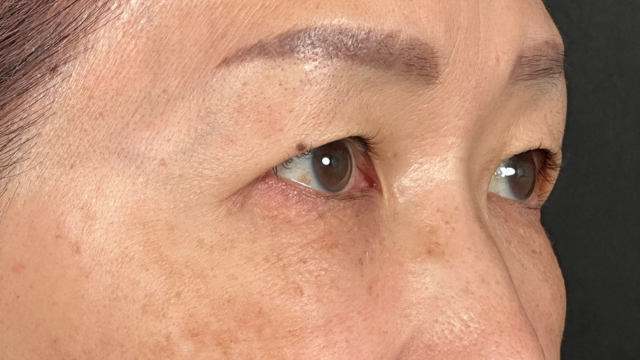 Postoperative Condition Part 1