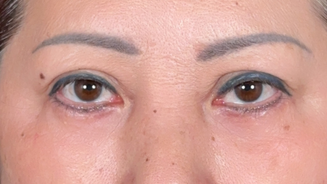 Postoperative Condition Part 1