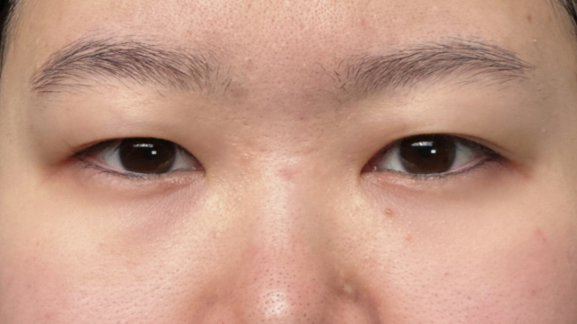 Postoperative Condition Part 1