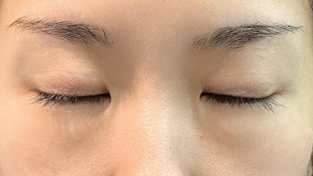 Postoperative Condition Part 1