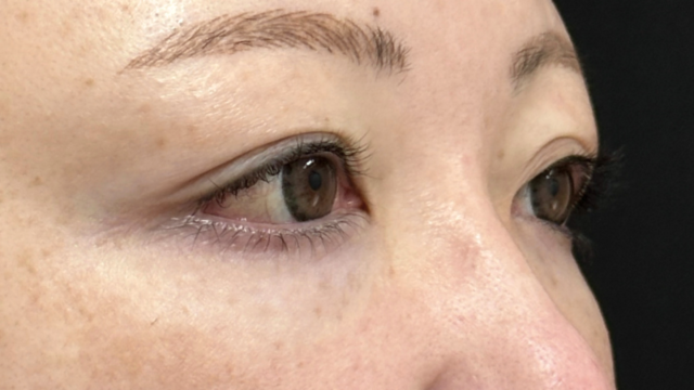 Postoperative Condition Part 1