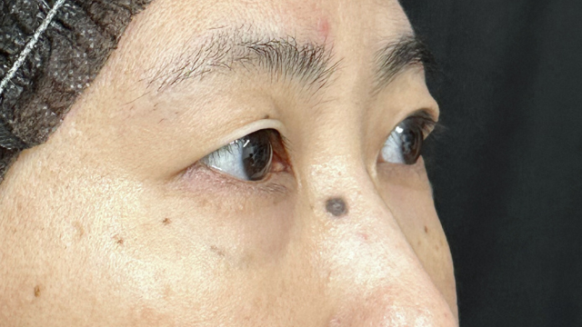 Postoperative Condition Part 1