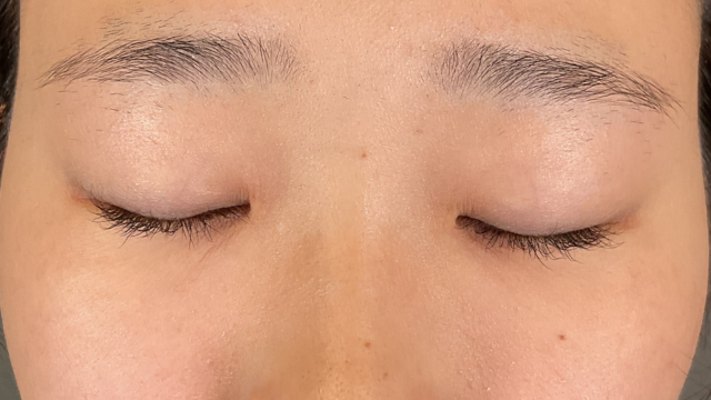 Postoperative Condition Part 1