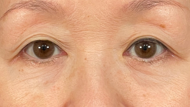 Postoperative Condition Part 1