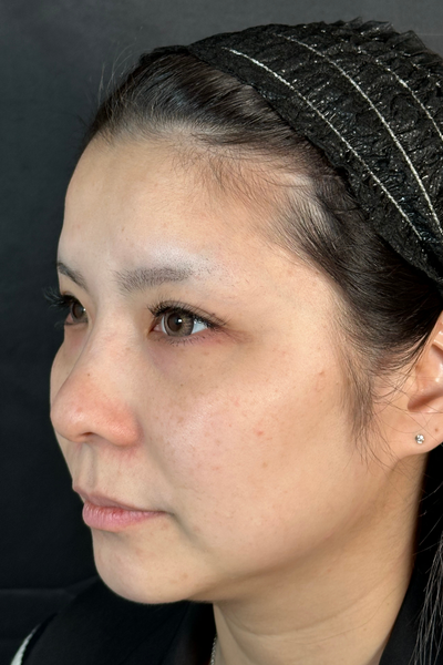 手術前の状態 その1