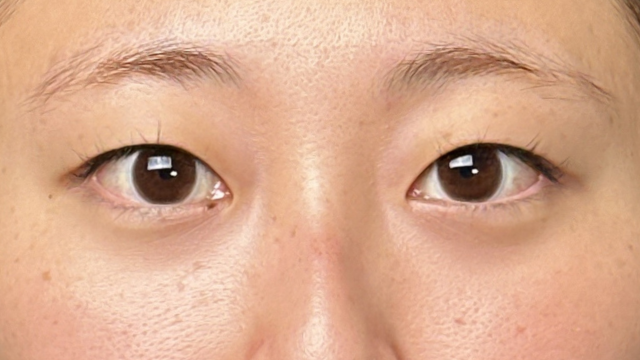 Postoperative Condition Part 1