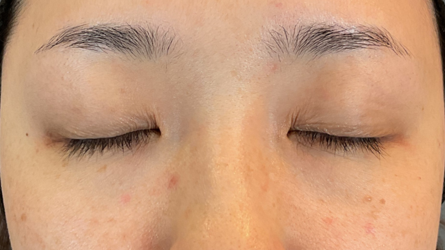 Postoperative Condition Part 1