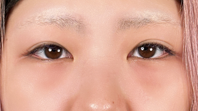 Postoperative Condition Part 1