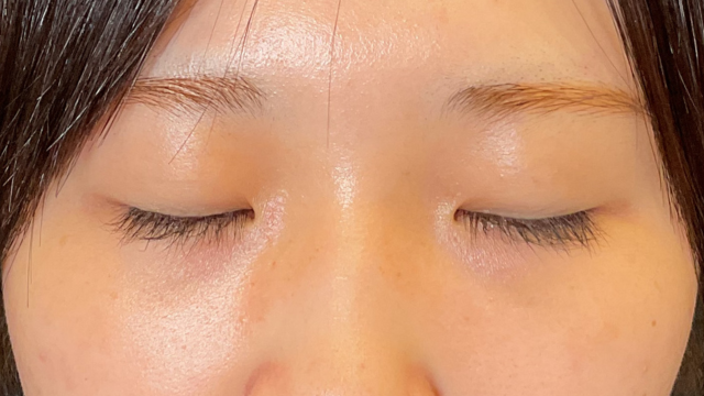 Postoperative Condition Part 1