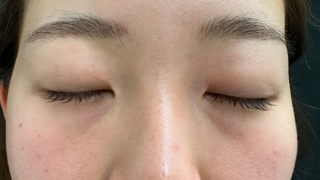 Postoperative Condition Part 1