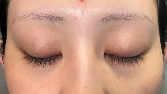 Postoperative Condition Part 1