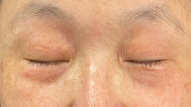 Postoperative Condition Part 1