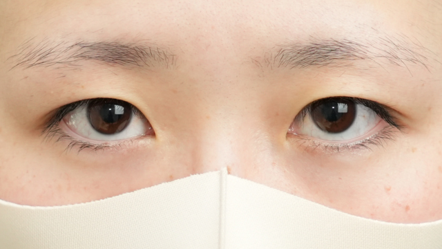 Postoperative Condition Part 1