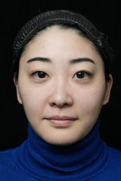 Postoperative Condition Part 1