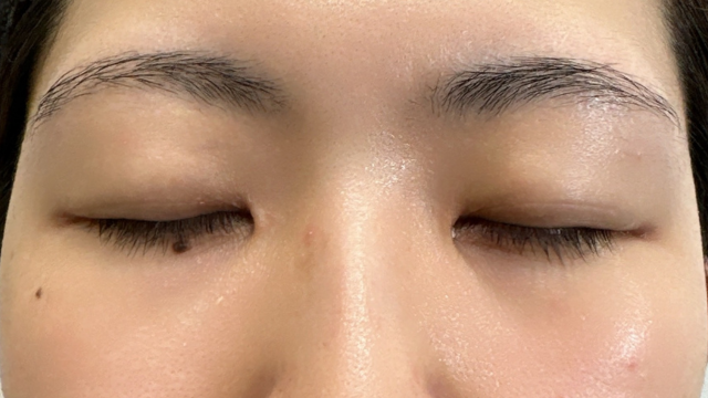 Postoperative Condition Part 1