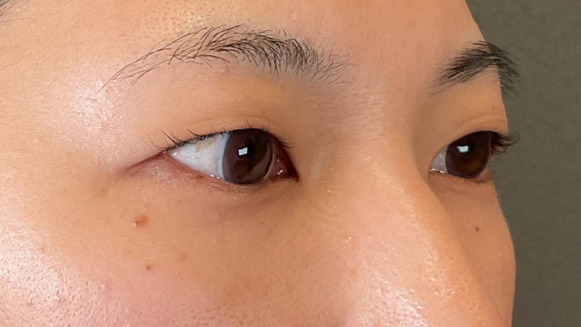 Postoperative Condition Part 1