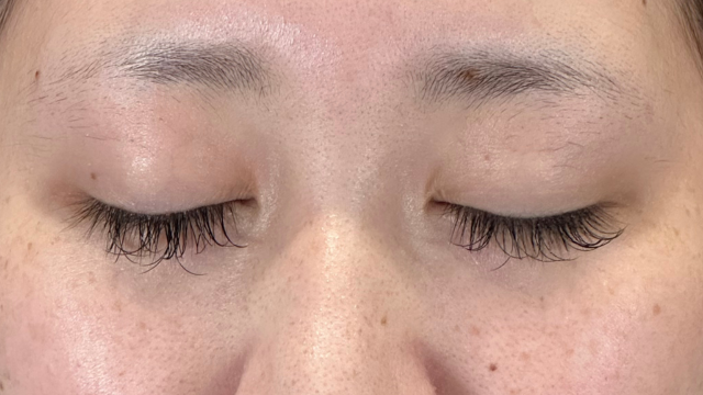 Postoperative Condition Part 1